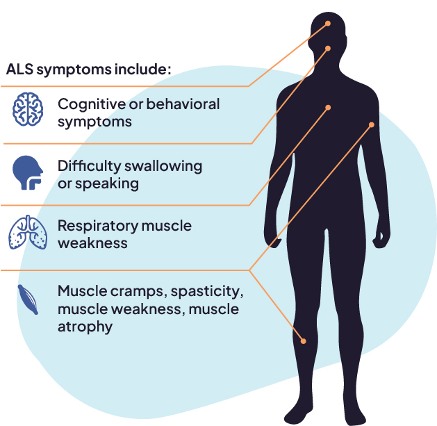 ALS Symptoms graphic