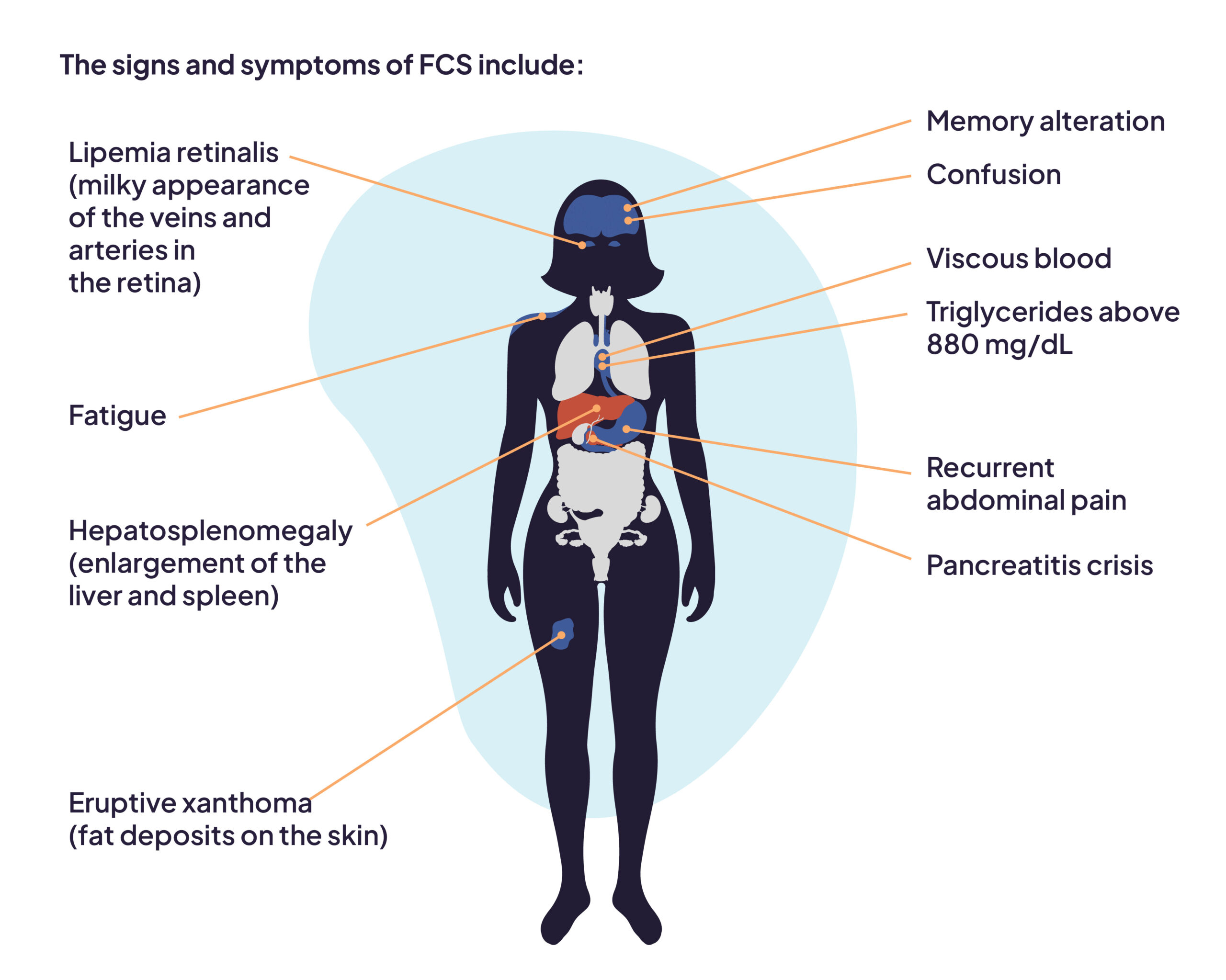 FCS Signs and Symptoms